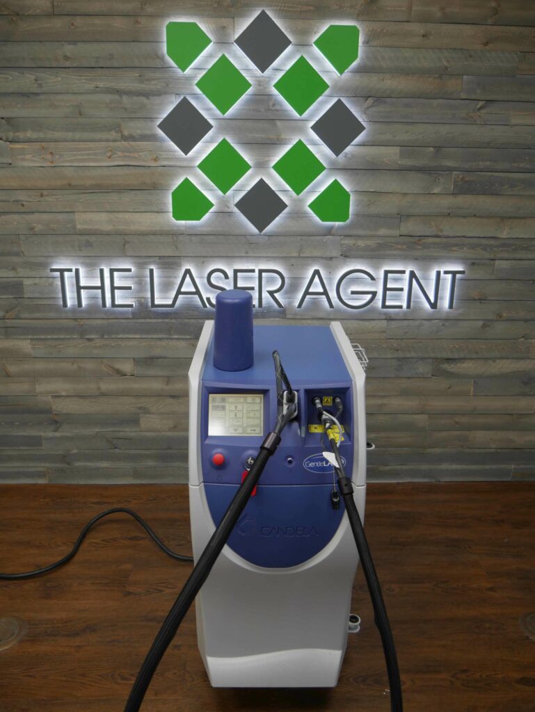 Certified Refurbished 2005 Candela Mini GentleLase Laser Machine for sale, Front View | The Laser Agent