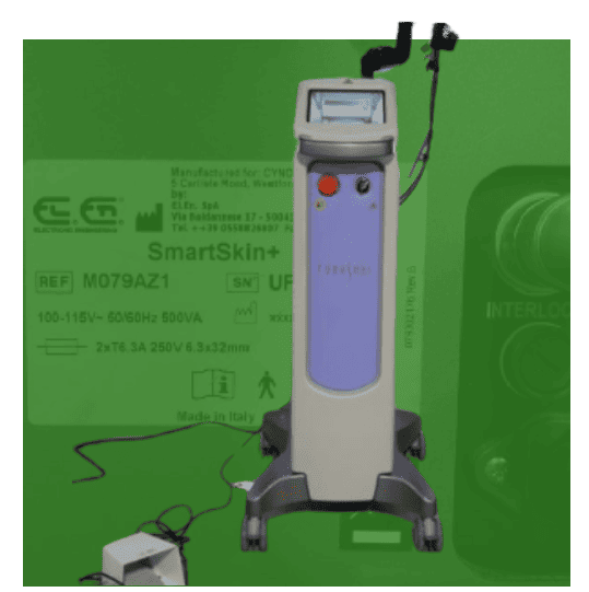 Cynosure Smartskin+