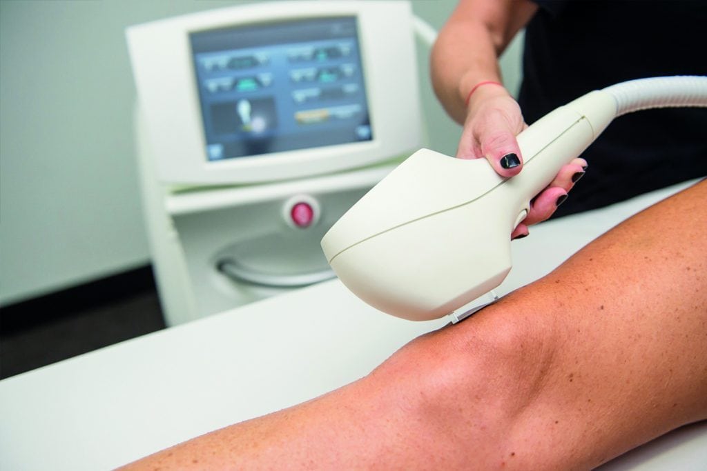 IPL Machine for Hair Removal