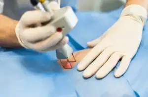 Pre-Owned-Aesthetic-Laser