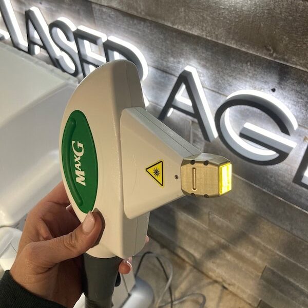 Cynosure Icon MaxG Handpiece Close Up