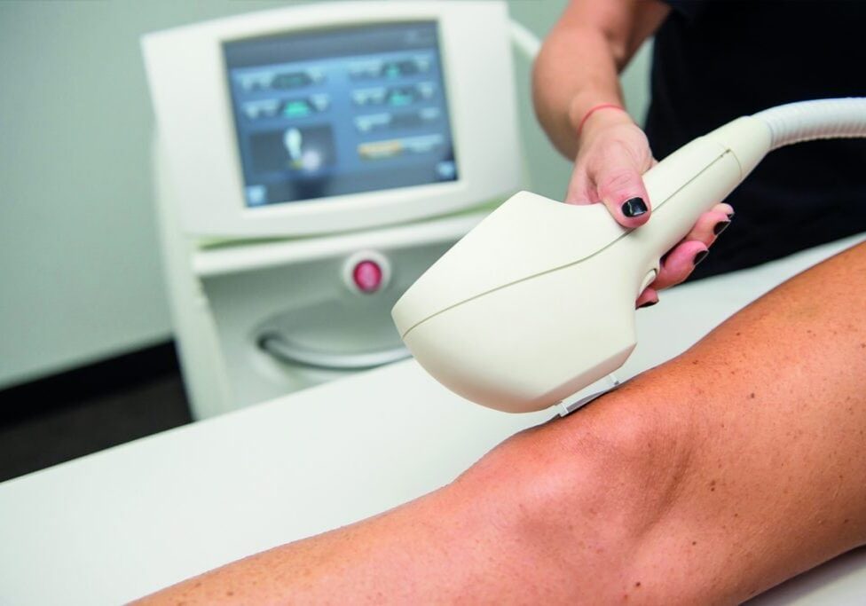 IPL Machine for Hair Removal
