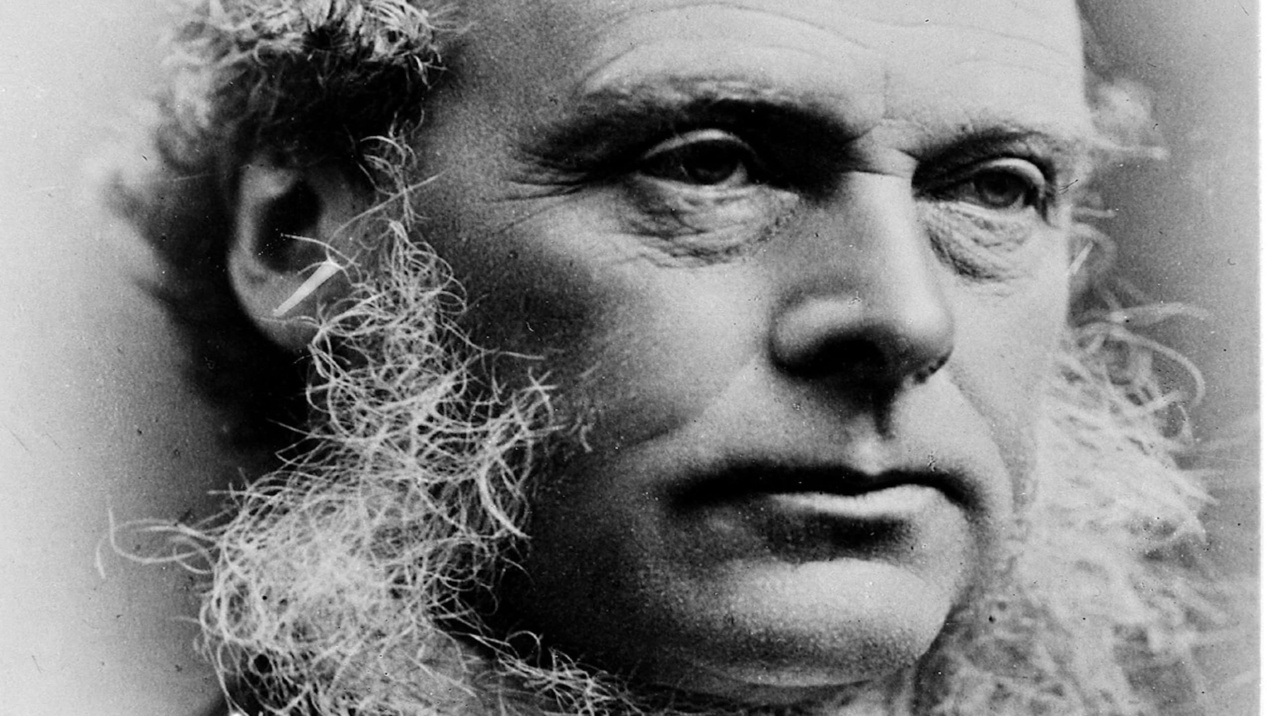 Joseph Lister