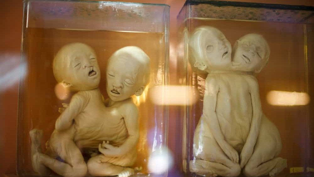 Saint Petersburg. RUSSIA. 07/20/2017. Spirited Siamese twins. In the collection of the Russian Emperor Peter the Great