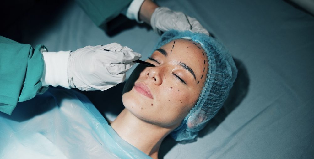 Plastic surgery, woman and hands drawing on face for change, cosmetics and beauty with medical service. Doctor, patient and mark on skin, filler or collagen in process for transformation in hospital