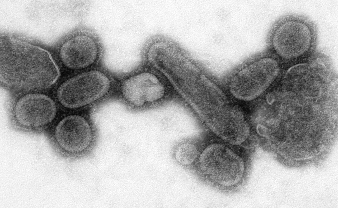 Reconstructed Spanish Flu Virus