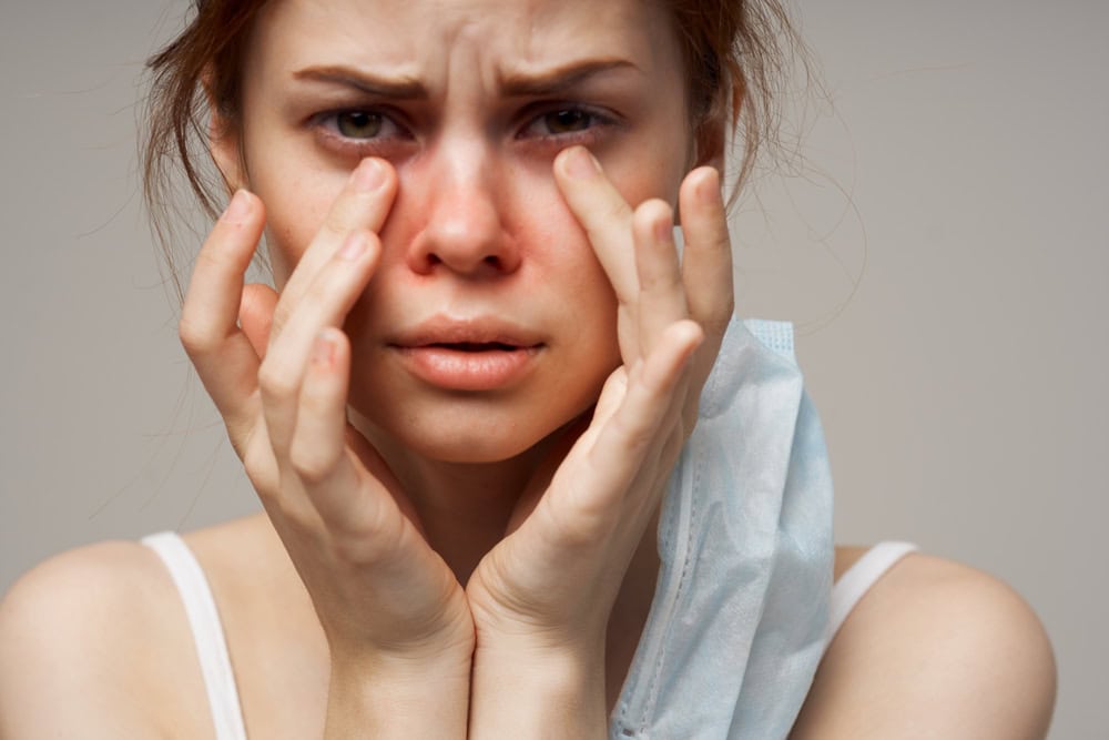 Unhealthy appearance of a woman red spots on the face