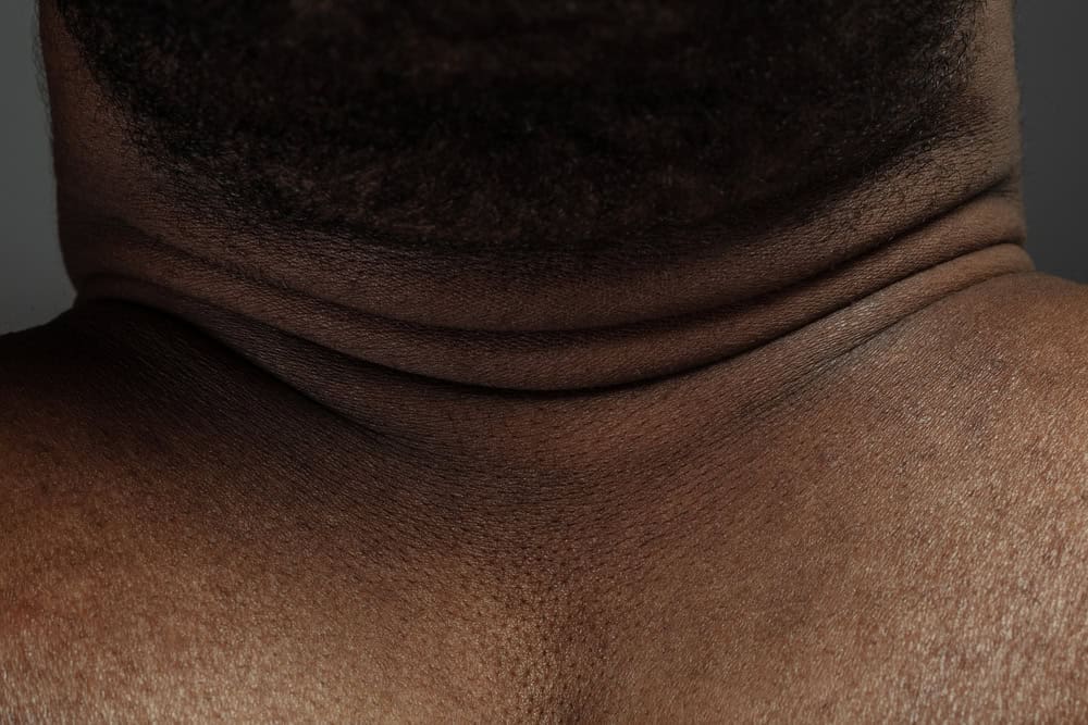 Head, neck. Detailed texture of human skin. Close up shot of young african-american male body. Skincare, bodycare, healthcare, hygiene and medicine concept. Looks beauty and well-kept. Dermatology.