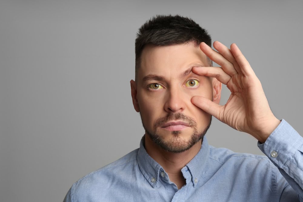 Man checking his health condition on grey background, space for text. Yellow eyes as symptom of problems with liver