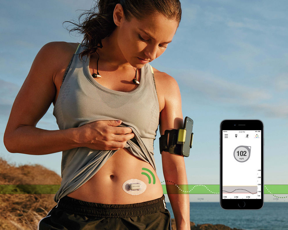 Детальна інструкція зі встановлення сенсора Dexcom G4, G5
