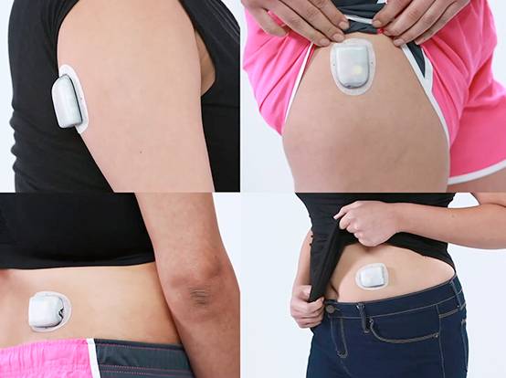 Безпровідна інсулінова помпа Omnipod DASH — компактна система для подачі інсуліну без шлангів, призначена для людей з діабетом 1 типу