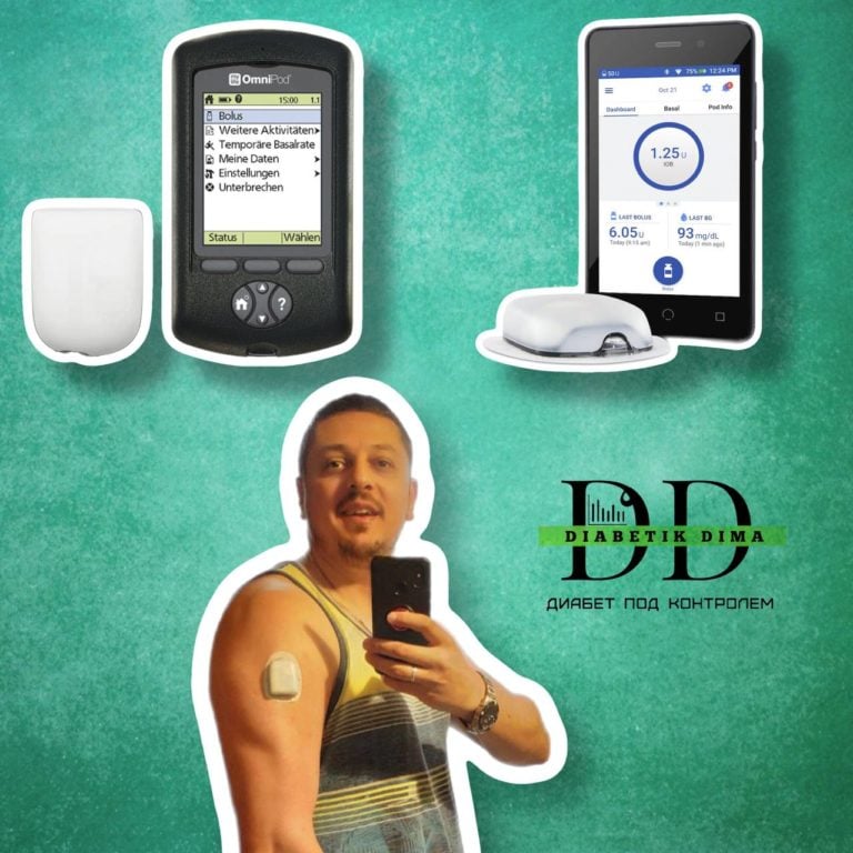Захищено: Бездротова помпа OmniPod: огляд і підключення