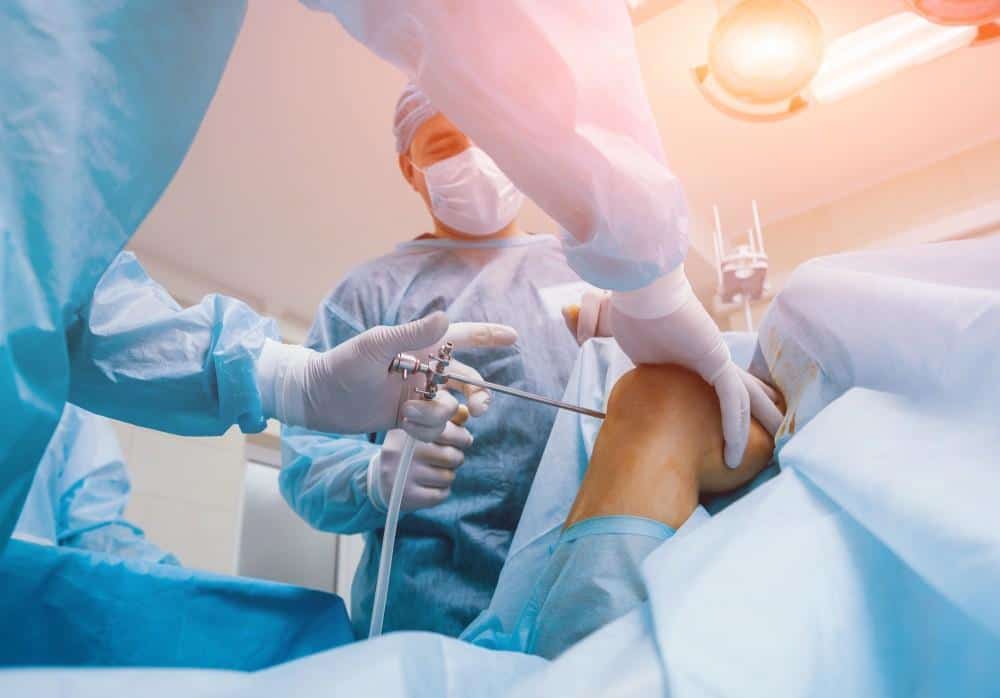 Arthroscopy Devices 4