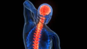Ischemic Stroke Drugs Market