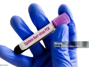 Mono Vaccines (Epstein-Barr virus)