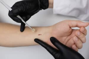Subcutaneous Biologics