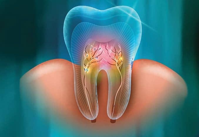 Endodontics Market Set for Steady Growth with Advancements in Root Canal Treatments and Technology