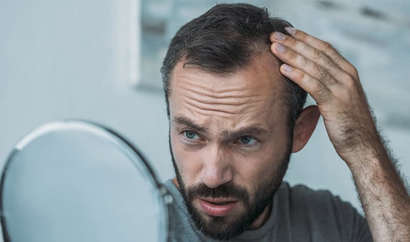 Alopecia Market Projected to Reach USD 16.09 Billion by 2030, Growing at a CAGR of 7.9%