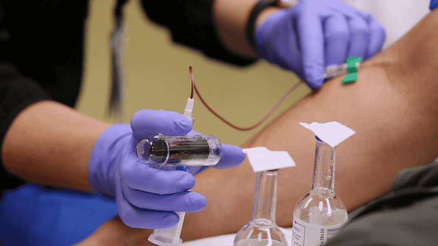 Blood Processing Devices & Consumables1