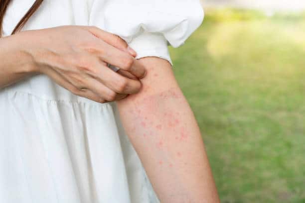 Food Allergy Treatment Market Dynamics: Regional Breakdown and Analysis
