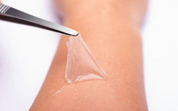 China Hydrogel Dressing Market Trends: Emerging Innovations and Dynamics