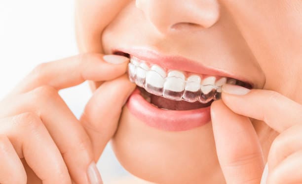 Invisible Orthodontics