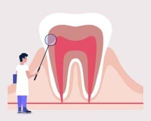 Periodontal Therapeutics
