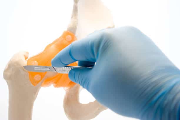 Spinal Fusion Devices