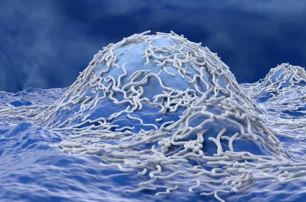 Ependymoma Market Revealed Horizons: Forecast 2035 Size, Share, and Growth Insights