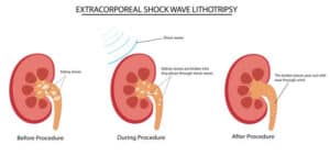 istockphoto-2182441272-612x612