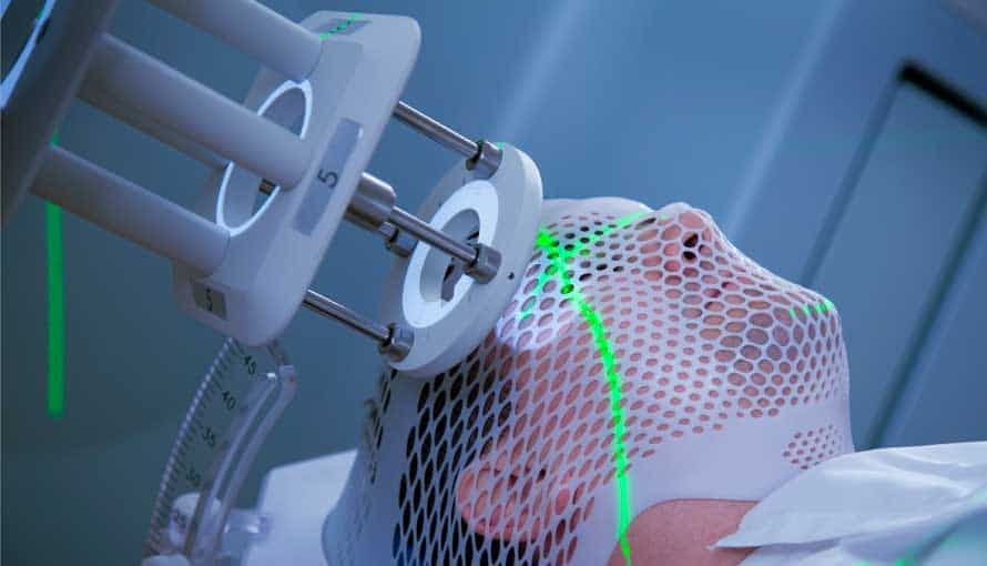 Brain Tumor Diagnosis & Therapeutics Market to Experience Significant Growth Driven by Advancements in Treatment and Diagnostics
