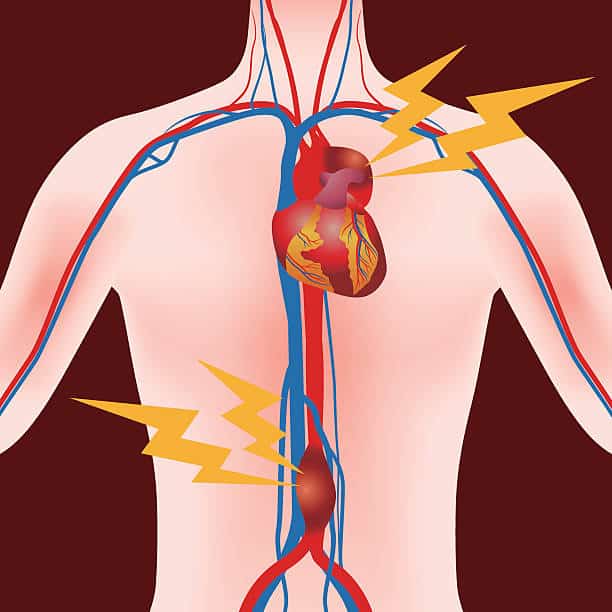 China Abdominal Aortic Aneurysm Market Growth: Innovation-Driven Strategy Insights