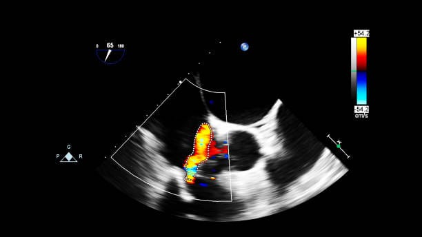 Japan Vocal Biomarkers Market Size, Share, and Demand Forecast (2025-2035)