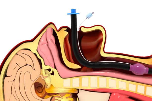 China Laryngoscopes Market Competitive Landscape: Forecast to 2035