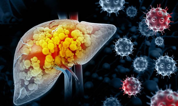 Hepatocellular Carcinoma Market In Focus: Size, Share, and Growth Trends Explored through 2035