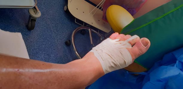 Advanced Wound Dressing