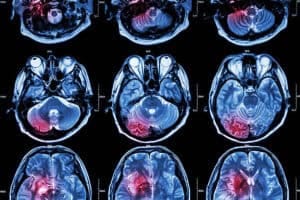 Cancer Imaging System