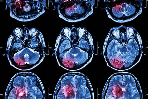 Cancer Imaging System