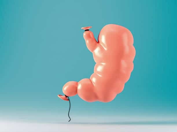 Gastric Balloon