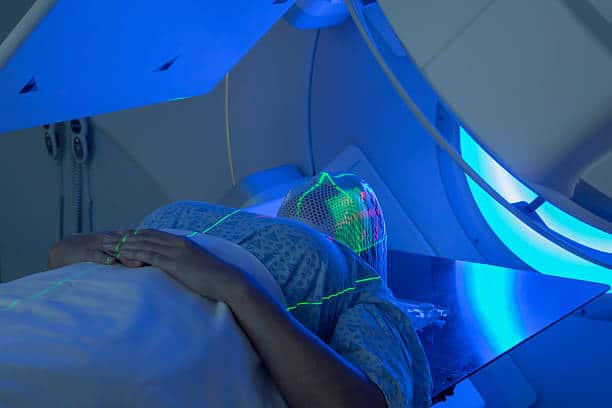 Head and Neck Cancer