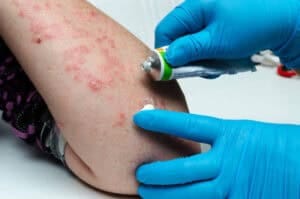 Medical Dermatomes