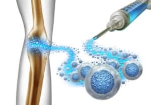 Mesenchymal Stem Cells