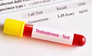 Premature Ejaculation Treatment