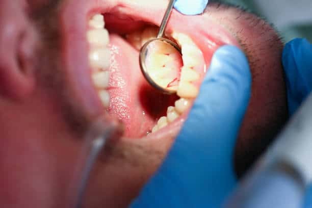 U.S Dental Laboratory Sealers Market Dynamics and Strategic Recommendations for 2025-2035