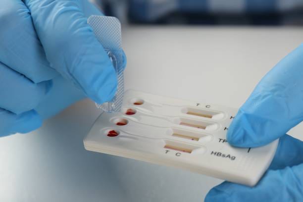 Singapore Hepatitis Test Solution Market Innovations: Trends and Strategic Opportunities