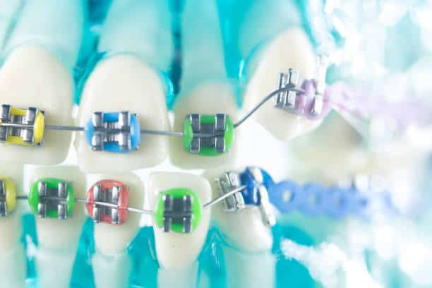 China Dental Sintering Ovens Market : Emerging Innovations (2025-2035) – A Comprehensive Report