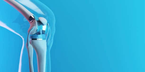 Artificial Implants