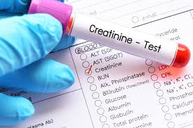 CREATINE