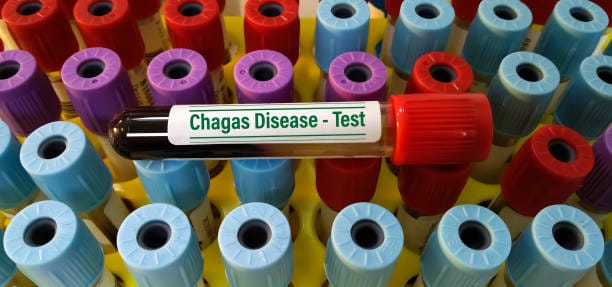 Chagas Disease Therapeutics