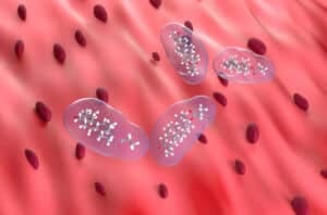 Endotoxemia